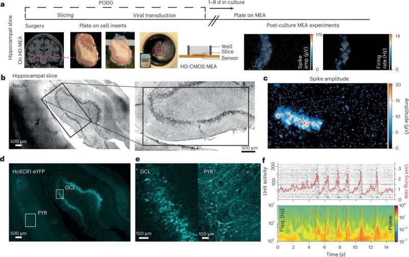 How optogenetics can put the brakes on epilepsy seizures