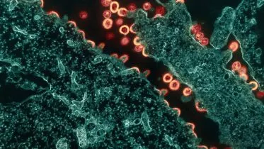 HIV 1 Virus Particles