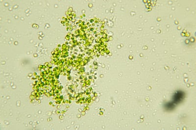 Abu Dhabi researchers believe green algae could help further cancer research. Photo: Sinhyu