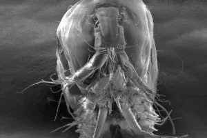 Electron microscope image showing the frontal view of a female Ikanecator primus.