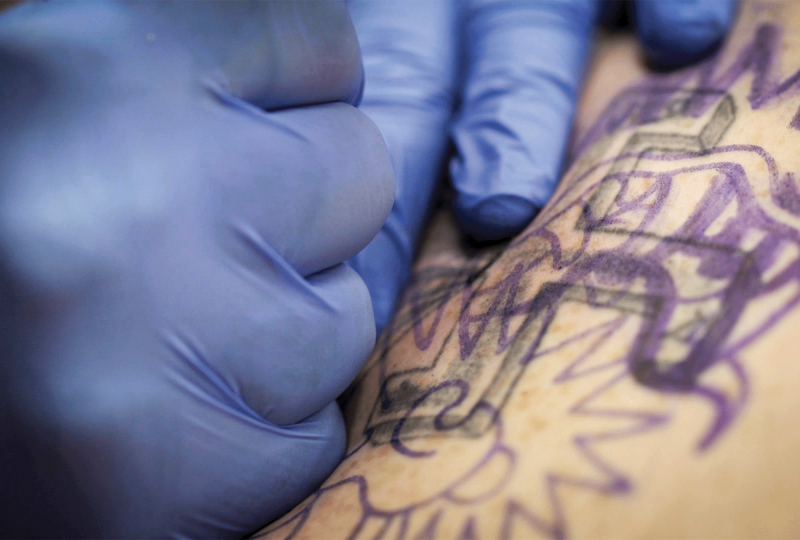 Gloved hands work on skin with swastika tattoo.