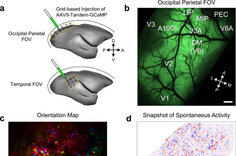 Understanding how primate neural mechanism distinguishes between spontaneous and stimulus-related activity