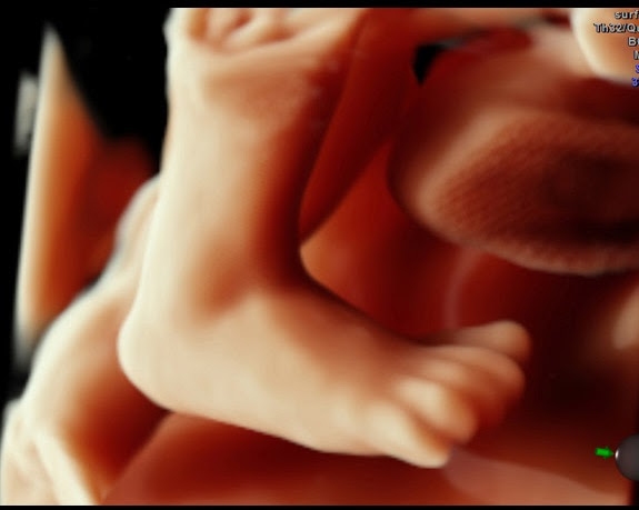 HDlive-33-week-fetus