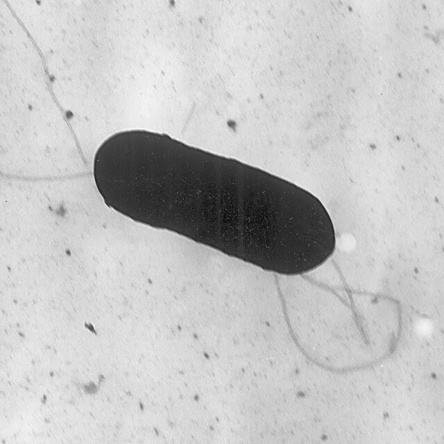 A 2002 electron microscope image shows a Listeria monocytogenes bacterium, capsule-shaped and dark.