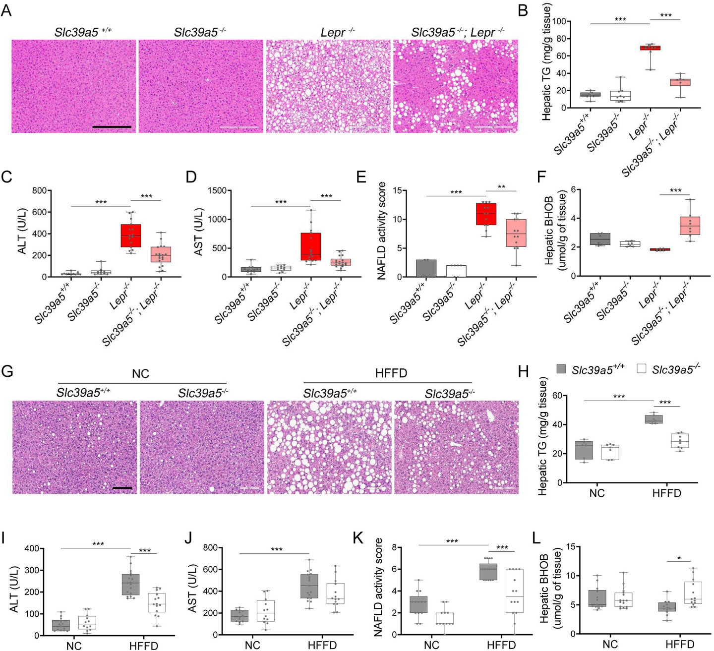 Loss of Slc39a5 improves liver function and steatosis in leptin-receptor deficient female mice and in female mice challenged with high fat high fructose diet (HFFD).