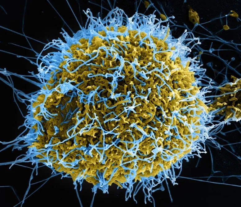 Ebola virus particles SEM NIAID