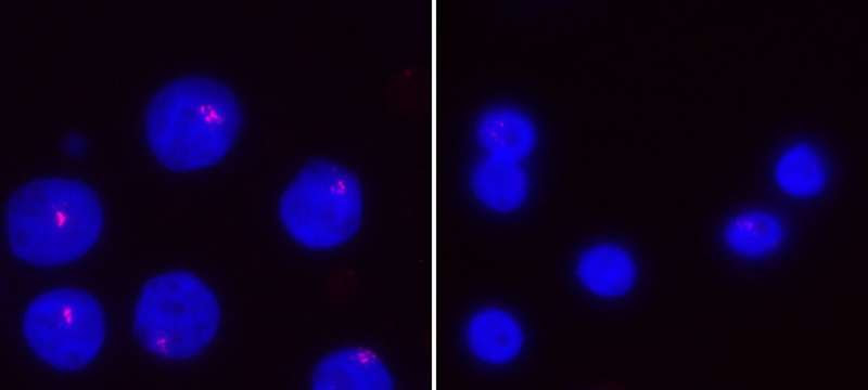 An integral T cell pathway helps regulate female gene expression