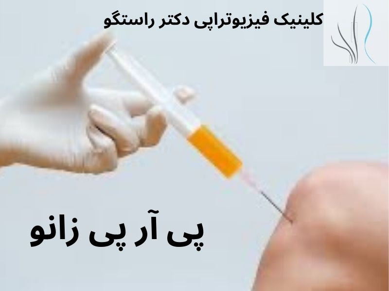 پی آر پی زانو چیست - مشکلات مربوط به زانو و راهکارهای پی آر پی - 3 1 - پی آر پی زانو چیست – مشکلات مربوط به زانو و راهکارهای پی آر پی پی آر پی زانو چیست - مشکلات مربوط به زانو و راهکارهای پی آر پی - 3 1 - پی آر پی زانو چیست – مشکلات مربوط به زانو و راهکارهای پی آر پی
