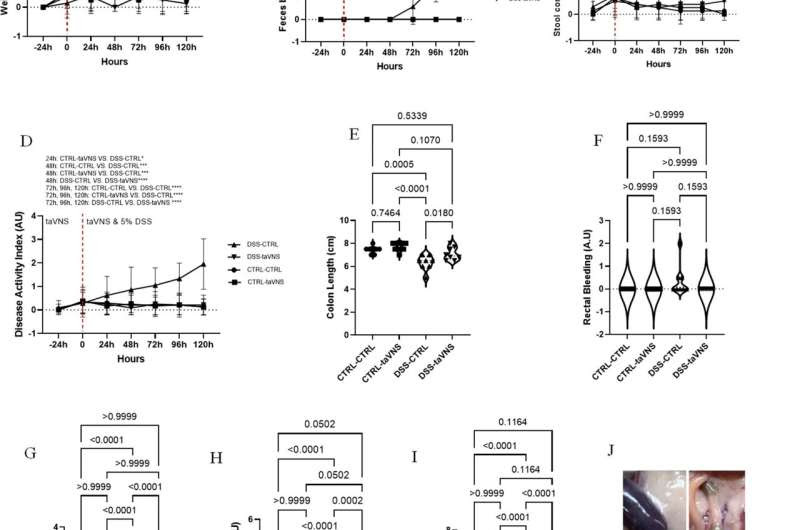 Electrical stimulation of ears shows promise for treating ulcerative colitis