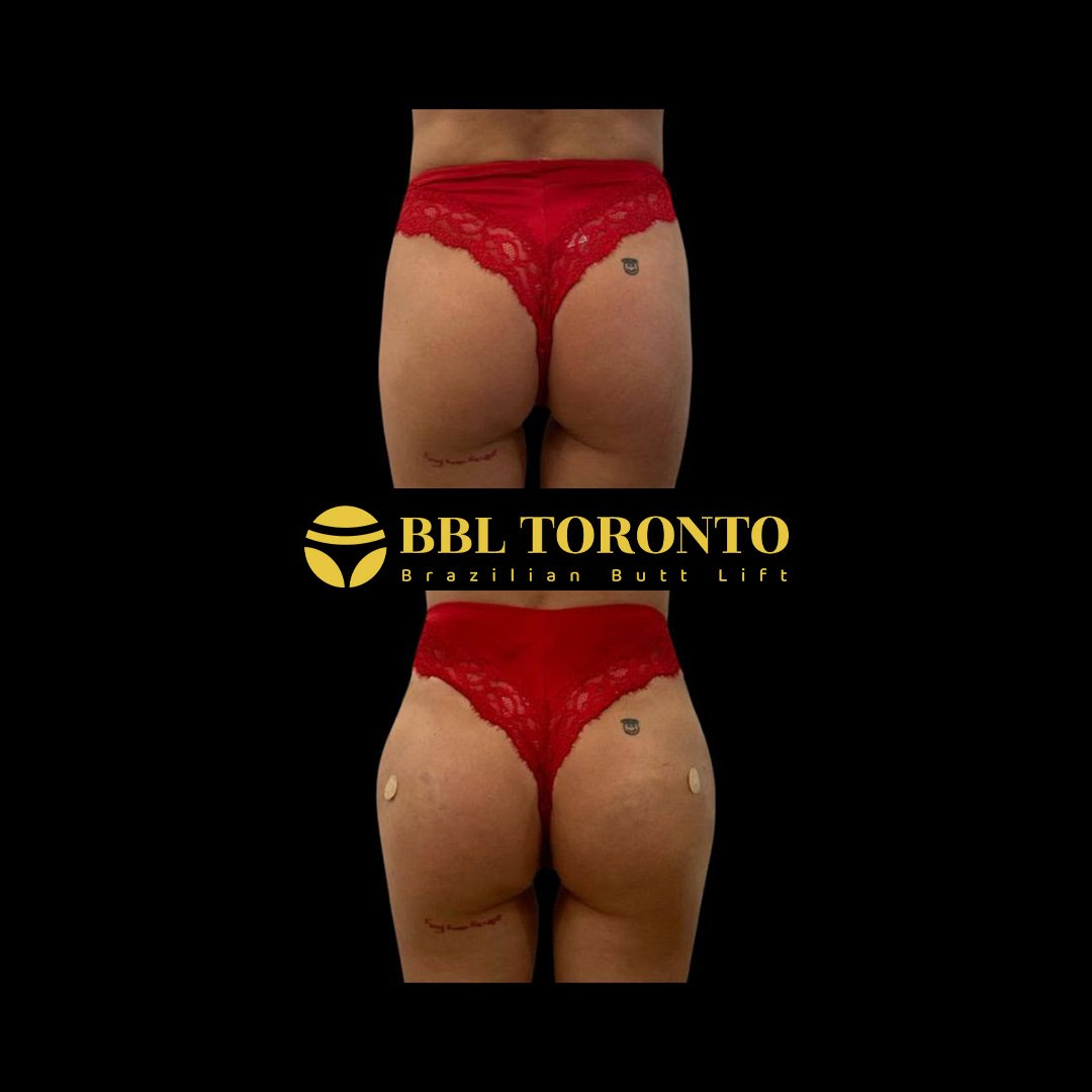 bbl09.1752466488.jpg