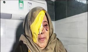 Un mujer anciana palestina herida en un ojo tras un ataque del Ejército de israel.