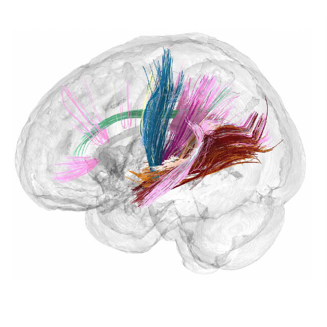 Two views of a transparent, computer-generated brain with several colorful dots and lines in the center indicating connectivity.