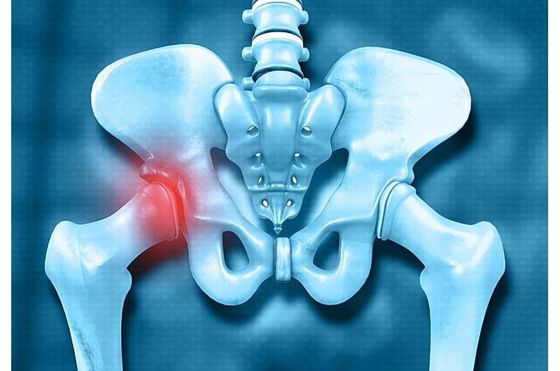 THA superior to resistance training for reducing hip pain, improving function