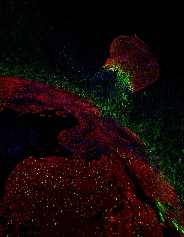 Heart Regeneration From Zebrafish to Mice