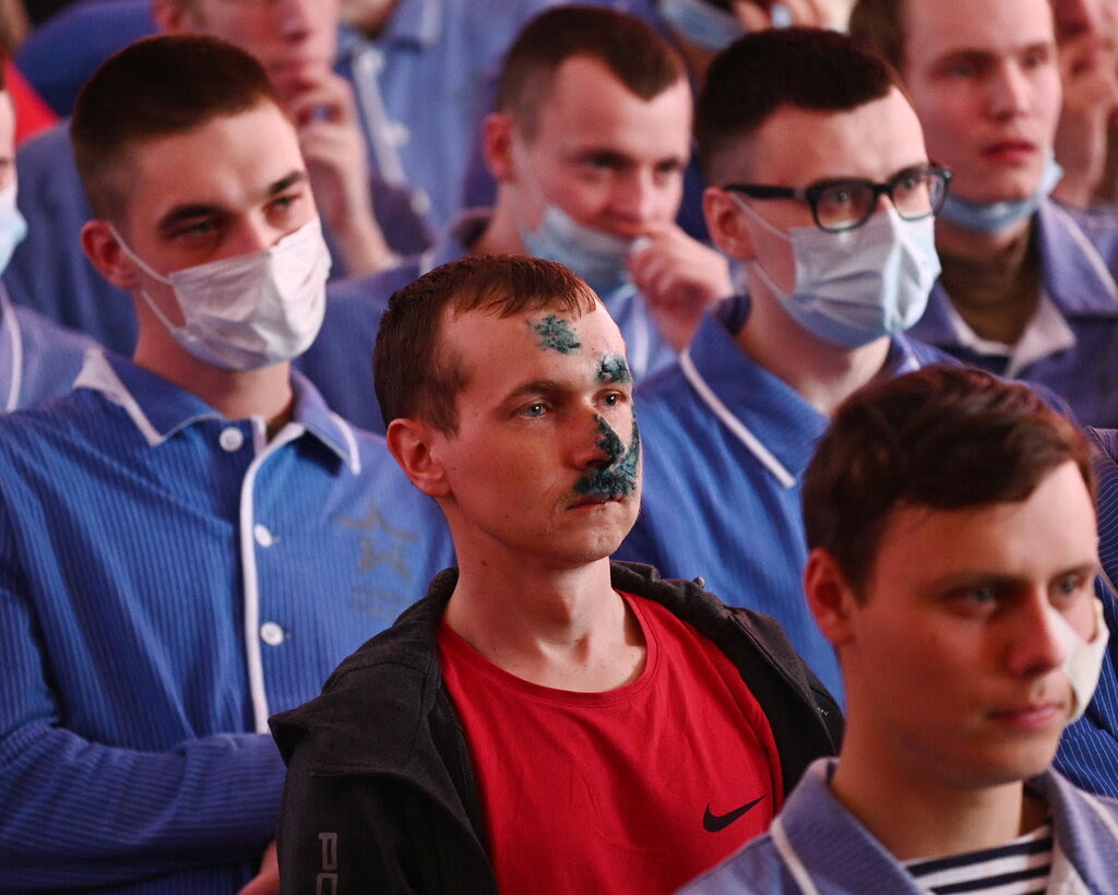 A close-up of men sitting down at a concert. Many of the men are wearing masks; others are bandaged or showing other signs of recent treatment for injuries. 