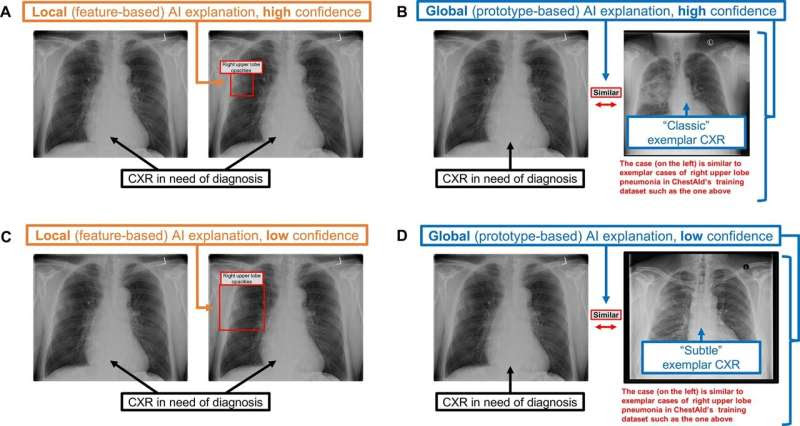 Incorrect AI advice influences diagnostic decisions