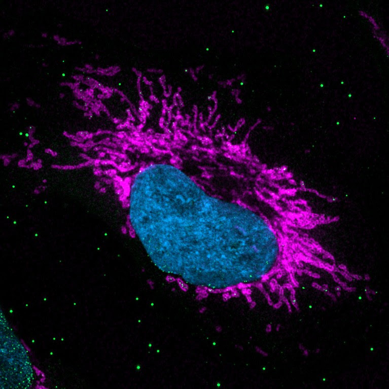 Mitochondria leaking DNA, which can trigger inflammation.