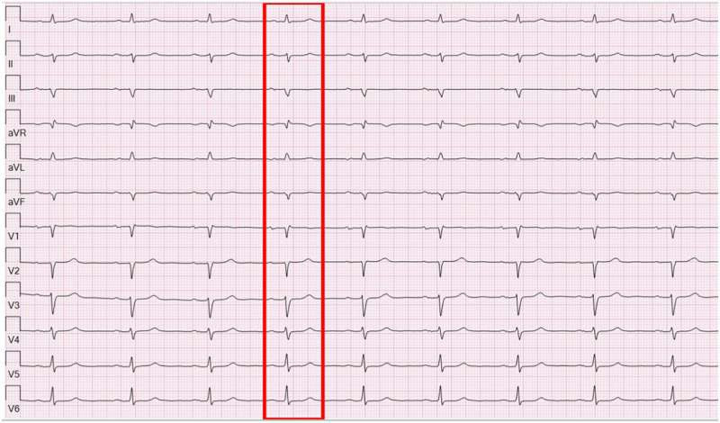 Cardiology collaboration advances machine learning predictions