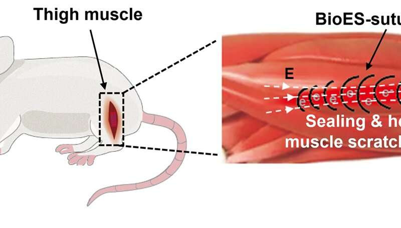 Stitches with internally produced electric charge found to speed up wound healing in rats