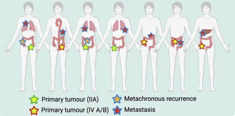 Researchers hope identification of new RNA molecules will help doctors predict if a patient's bowel cancer will return