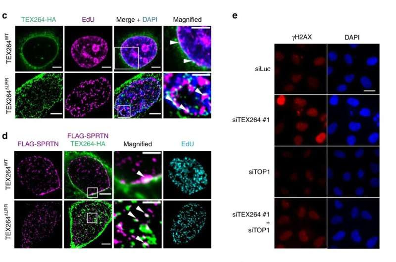 Experts discover toolkit to repair DNA breaks associated with aging, cancer and motor neuron disease