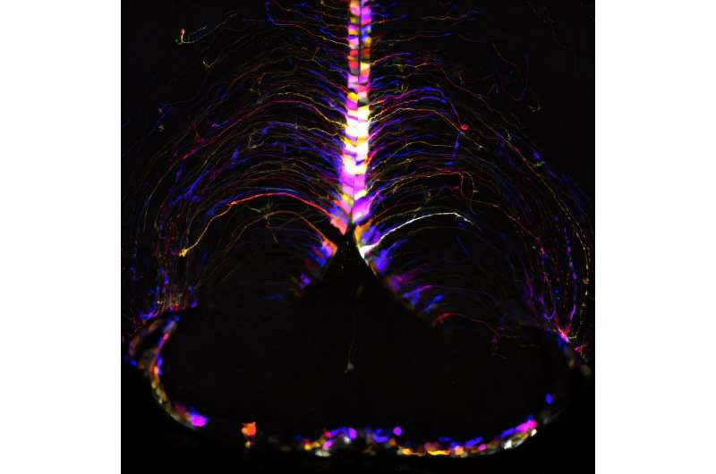 Key players in brain aging: New research identifies age-related damage on a cellular level