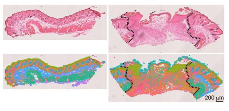 Some senescent cells heal, others hinder