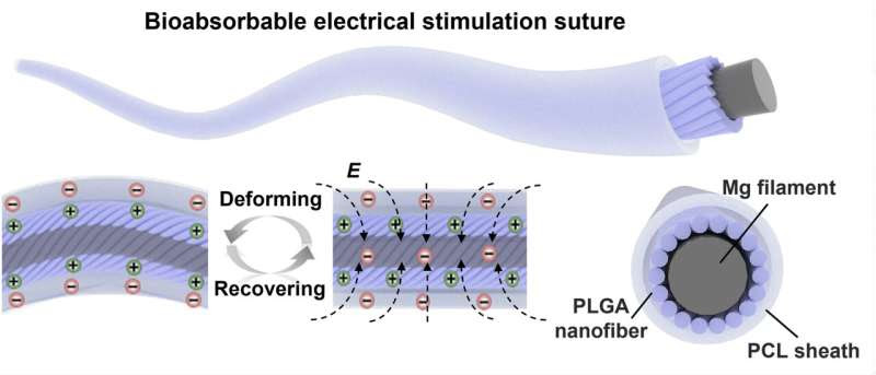 Stitches with internally produced electric charge found to speed up wound healing in rats