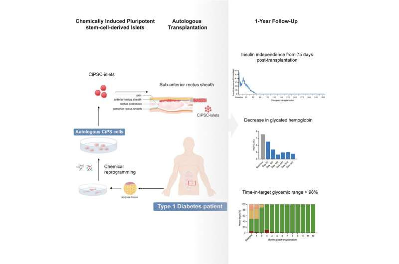 Stem cell therapy reverses type 1 diabetes in world first