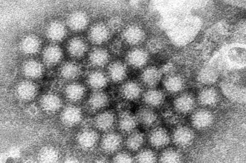 norovirus