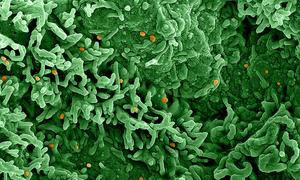 El virus mpox (naranja) infecta las células representadas en verde.