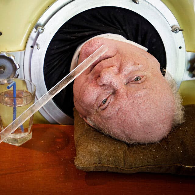 A man, Paul Alexander, looks out from inside a yellow iron lung that he uses to breathe. Beside him there is a glass of water with a straw.