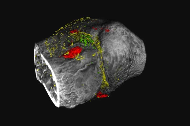 New technique allows technicolor imaging of degenerative joint disease