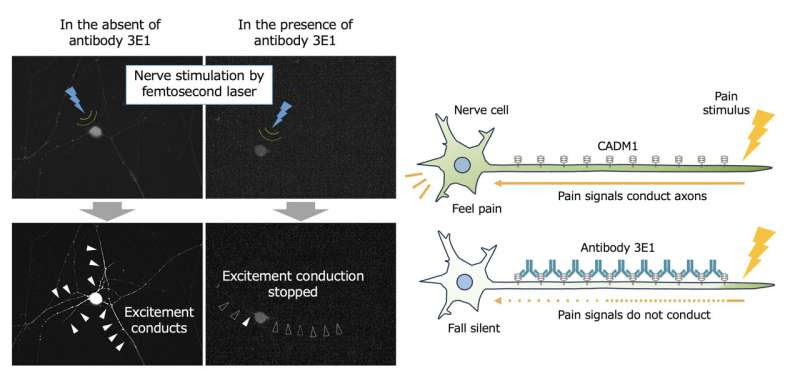 New antibody targeting nerve cells offers long-lasting pain relief