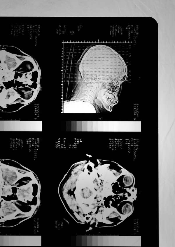 X-ray images showing multiple views of a human skull from different angles