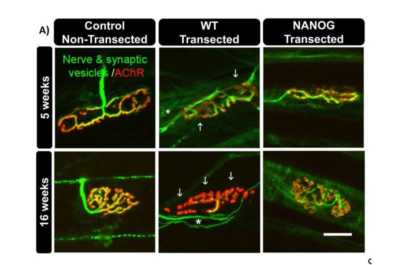 Gene named for mythical Irish land could aid muscle function after traumatic nerve injuries