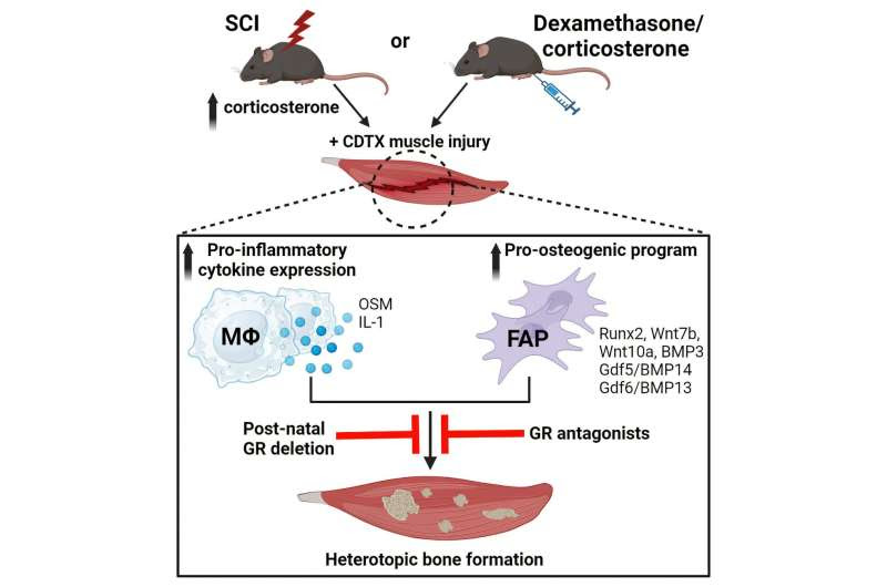 Cortisol identified as cause of joint ossification in spinal cord injuries