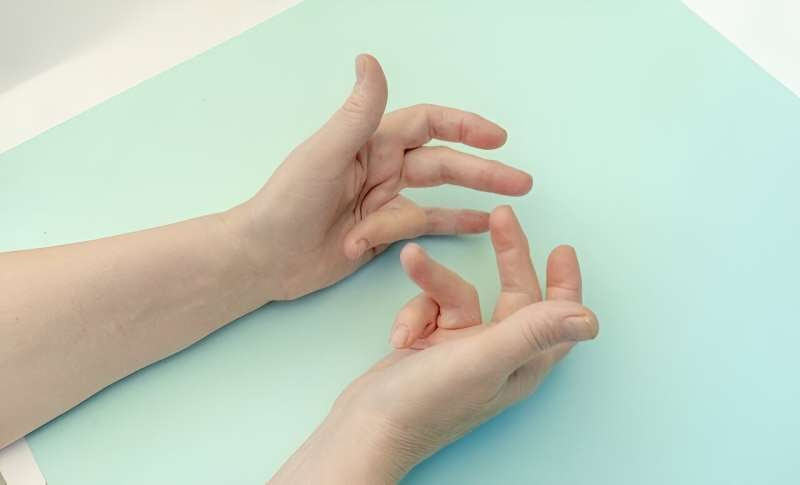 Initial outcomes comparable for dupuytren contracture treatments