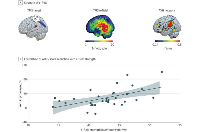 Transcranial magnetic stimulation reduces auditory hallucinations