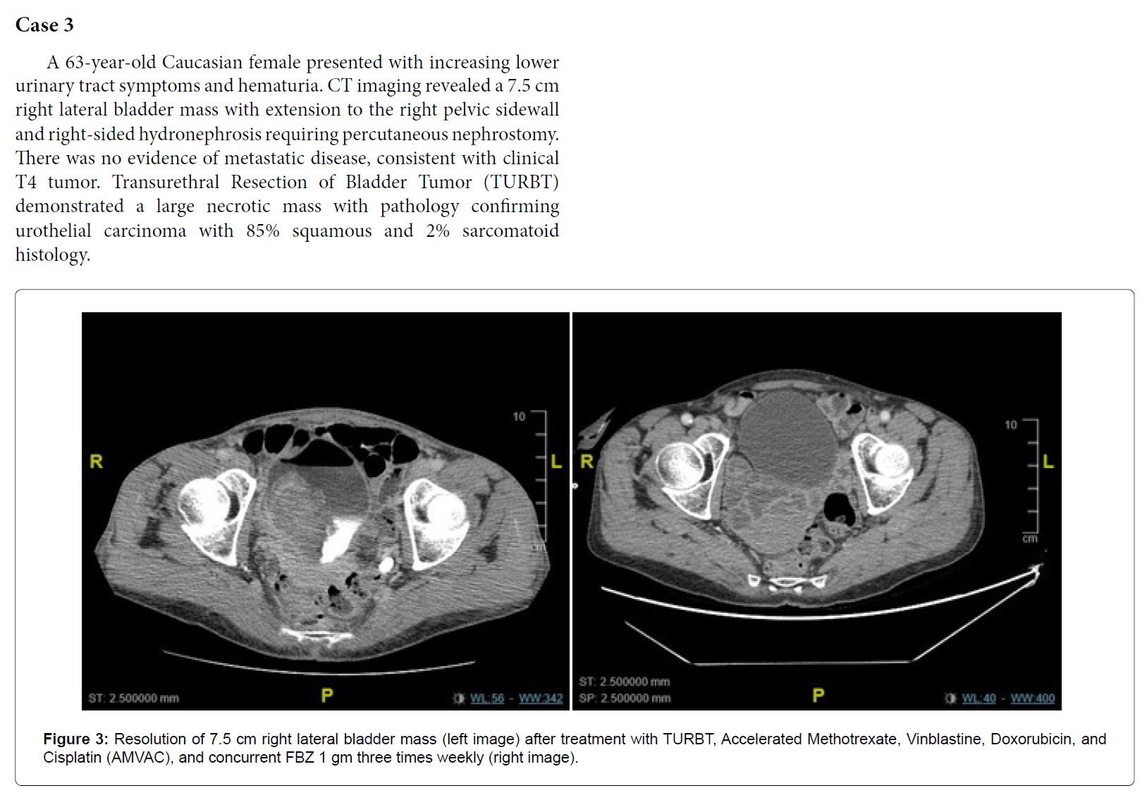 Case Studies of Patients Who Cured Their Own Stage 4 Cancers