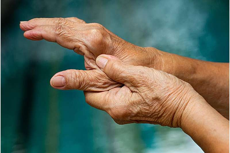 Bidirectional association found between rheumatoid arthritis, COPD