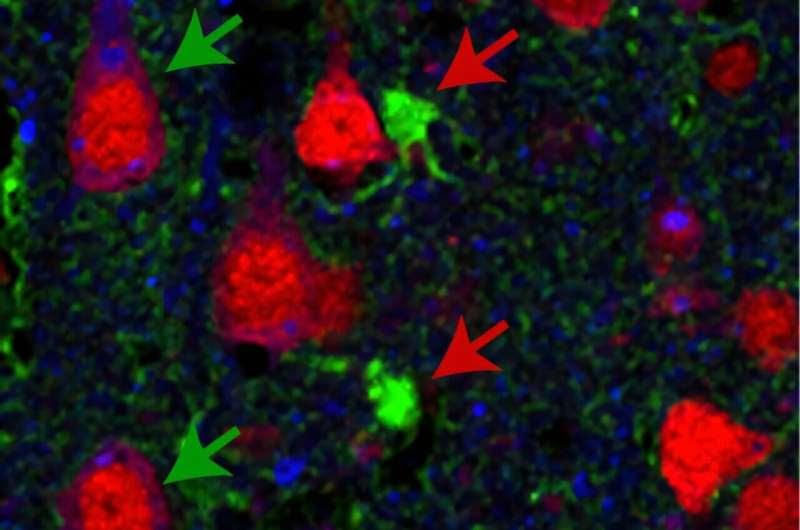 Gene therapy protects against motor neuron disease in rats