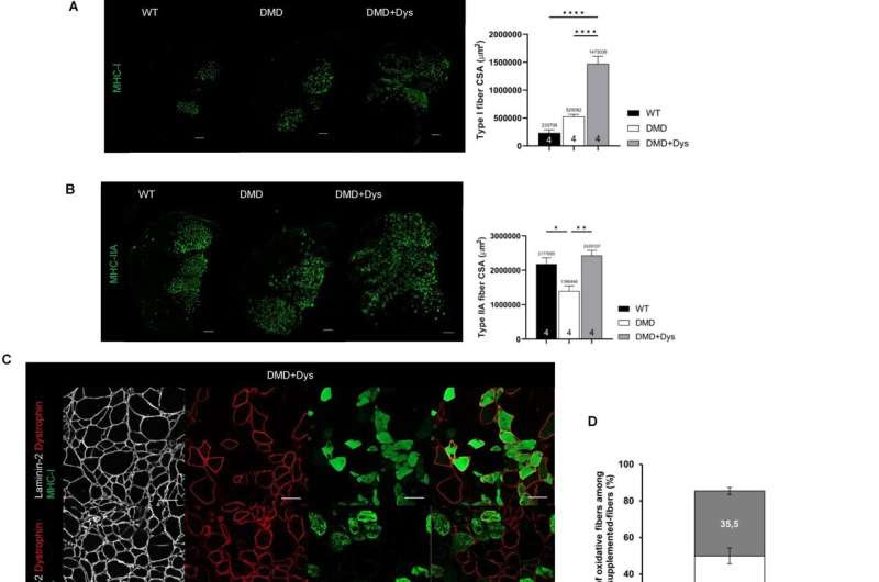 Preventing skeletal muscle fatigue in Duchenne muscular dystrophy through cell therapy