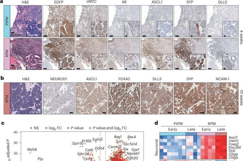 New insights show ASCL1's role in neuroendocrine prostate cancer, an aggressive and treatment-resistant type