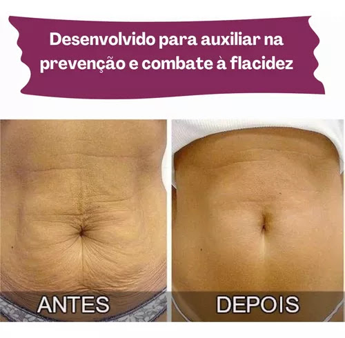 Kit Creme Massagem Anti Flacidez E Estria Dmae Dagua Natural