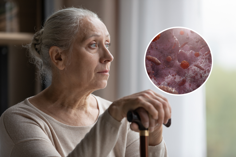 An old woman looks out of a window leaning on a walking stick, with a rendering of microorganisms in the gut overlayed. Scientists have found a possible link between the bacteria in our guts, and the risk of developing Alzheimer's disease in old age. fizkes/Getty Images / Canva