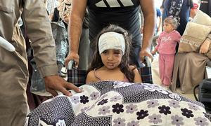 Una misión conjunta de la ONU en el norte de Gaza ayudó a trasladar a algunos pacientes, como esta niña, del Hospital Kamal Adwan al Hospital Al-Shifa.