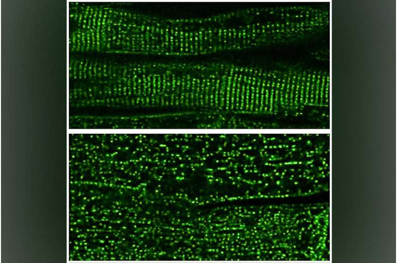 Shoring up heart muscle's mini 'managers' to treat heart failure