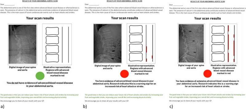 Provision of blood vessel calcification imaging results may improve cardiovascular risk control