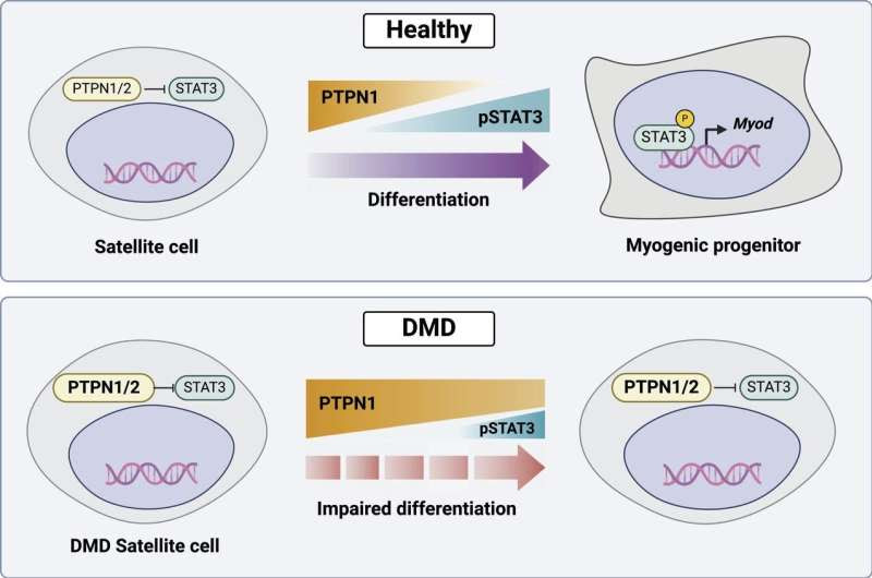 New drug shows promise against Duchenne muscular dystrophy